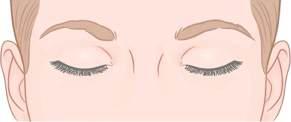 THE EYE-OPENING SECRET TO YOUTHFUL LOOKS BLEPHAROPLASTY