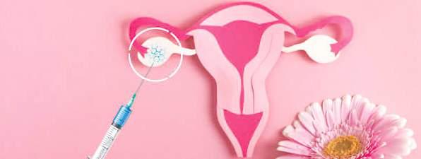 OVARIAN REJUVENATION: A BREAKTHROUGH IN FERTILITY TREATMENT
