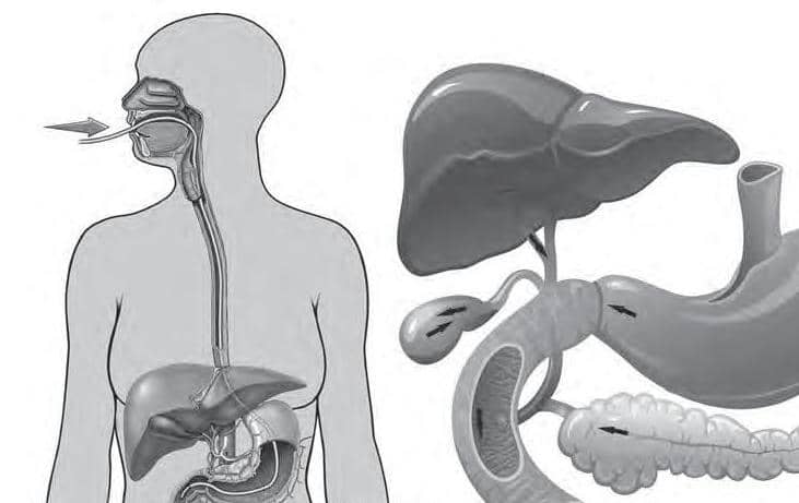 இரைப்பை அழற்சி (GASTRITIS)
