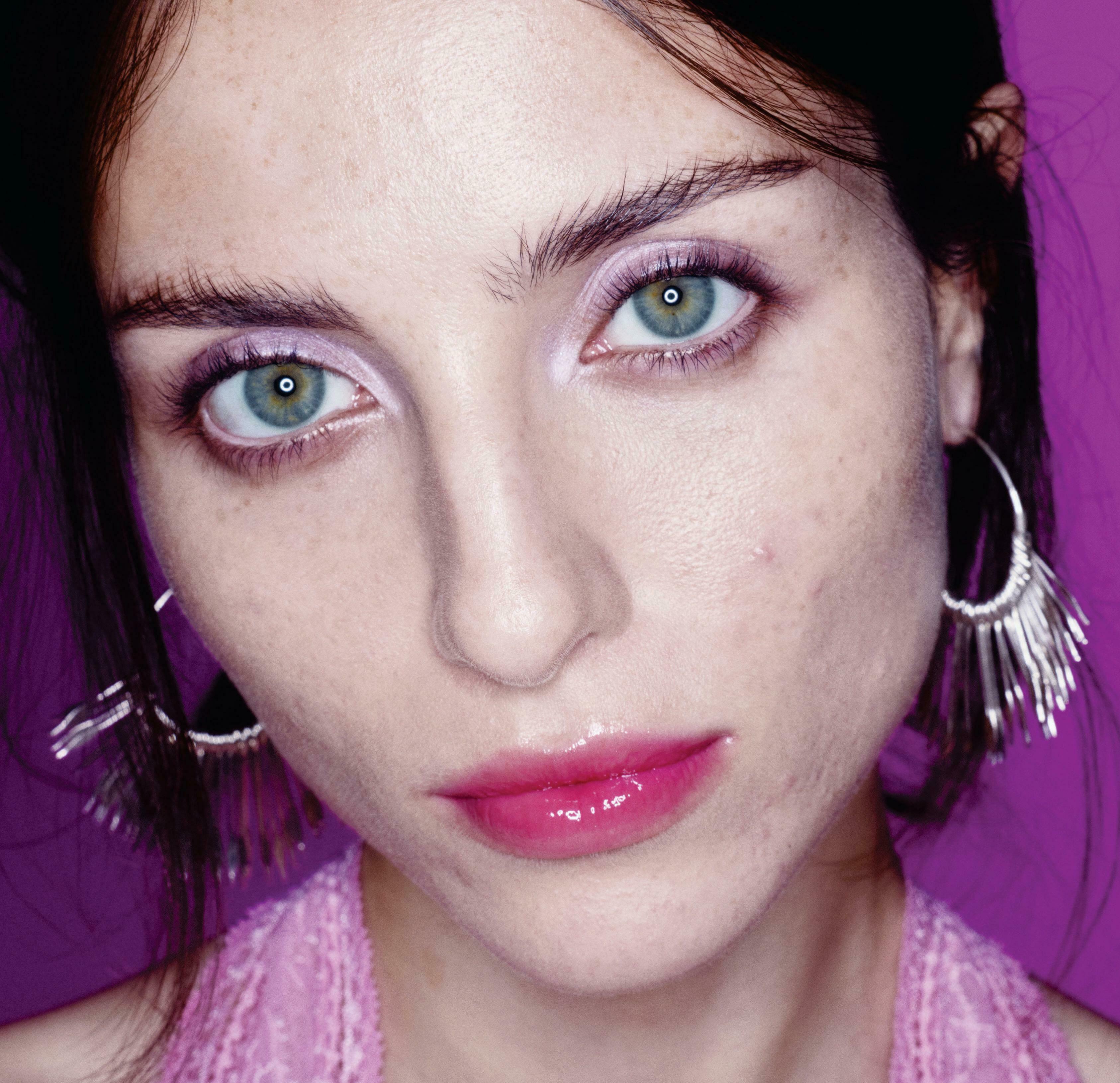 Madeline Argy's Acne Diaries