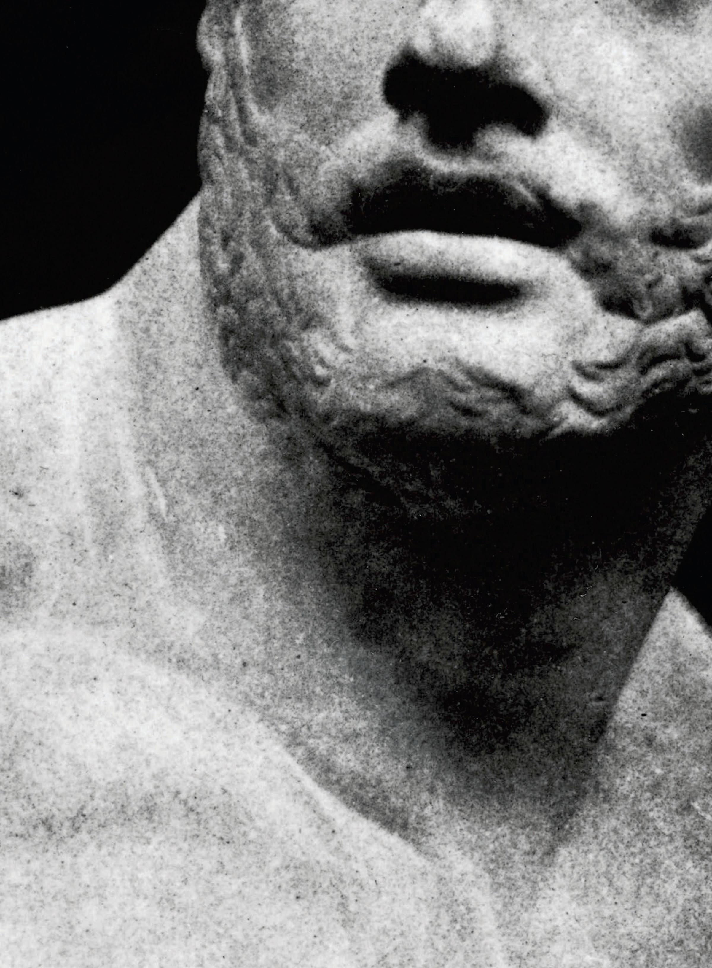 THE ADONIS INJECTION