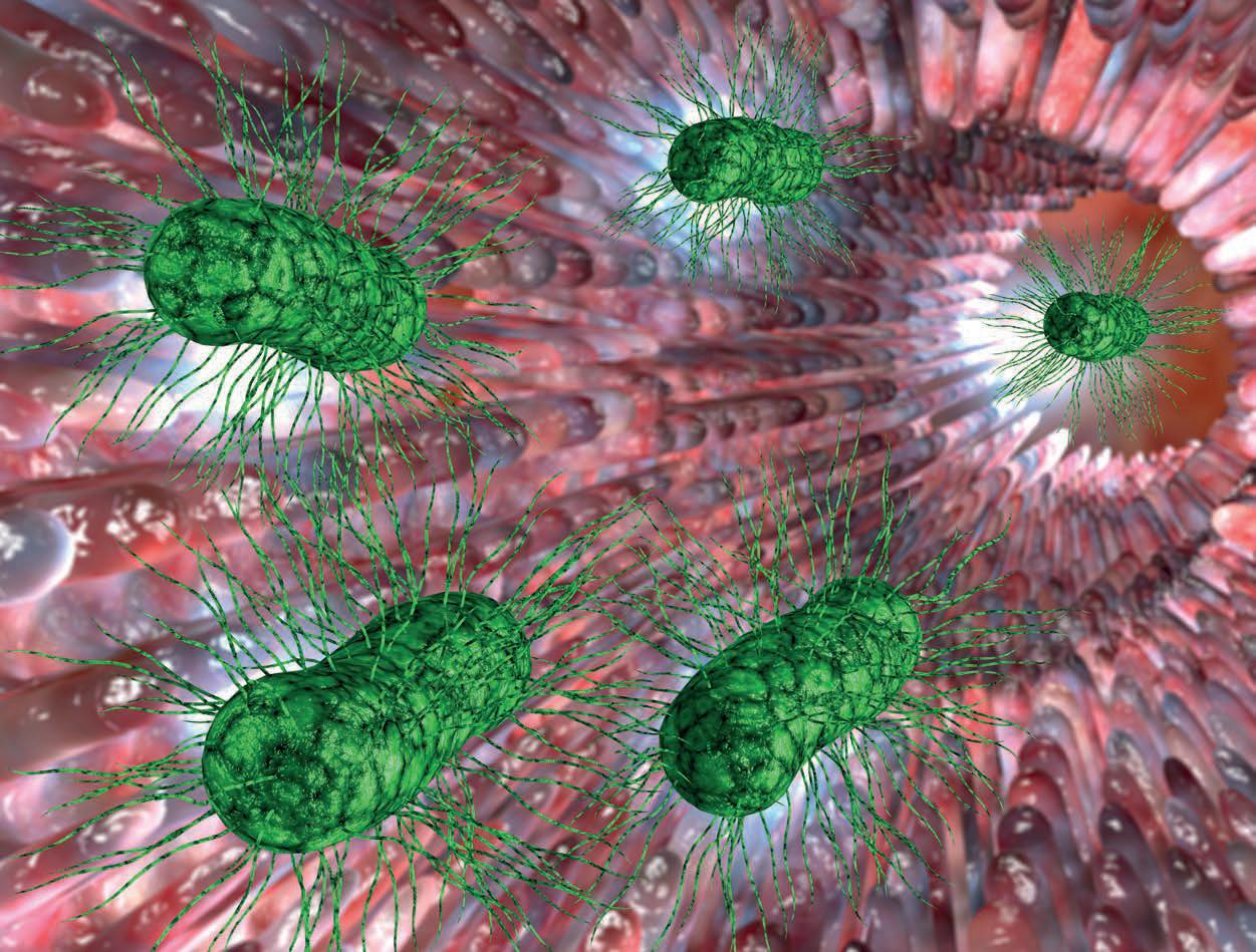 ¿Qué sabemos realmente sobre la proliferación bacteriana intestinal?- Qué podemos hacer con el SIBO