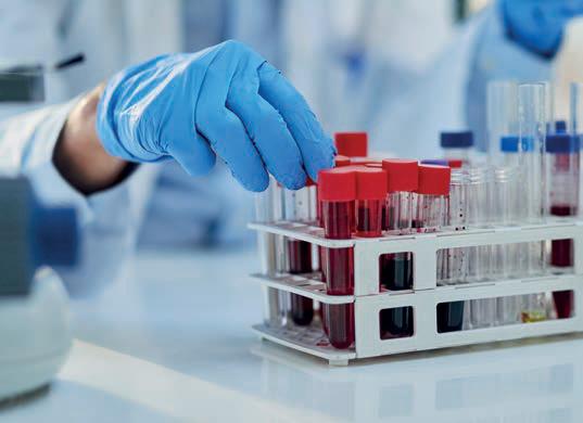UN ANÁLISIS DE SANGRE DETECTA 5 TIPOS DE CÁNCER EN FASE INICIAL