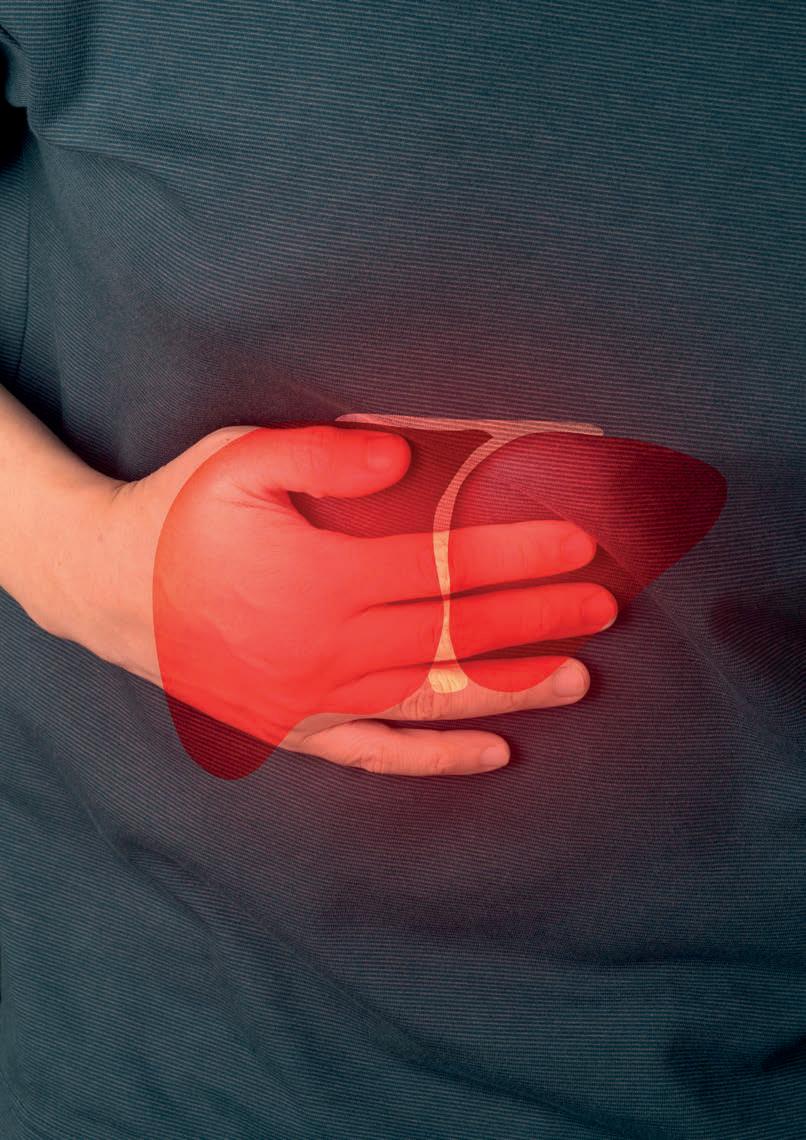 Esteatosis e inflamación hepática no vírica