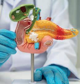 Ozempic: aumentan los casos de pancreatitis aguda