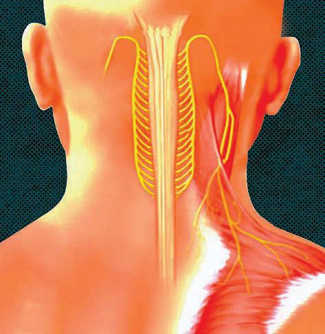 The 11th nerve