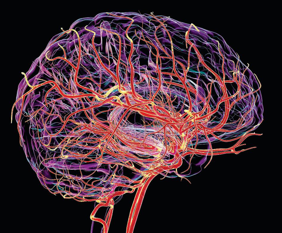 Cerebral cues