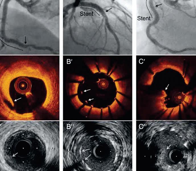 Smart Hearts How Technology is Transforming Heart Disease Care