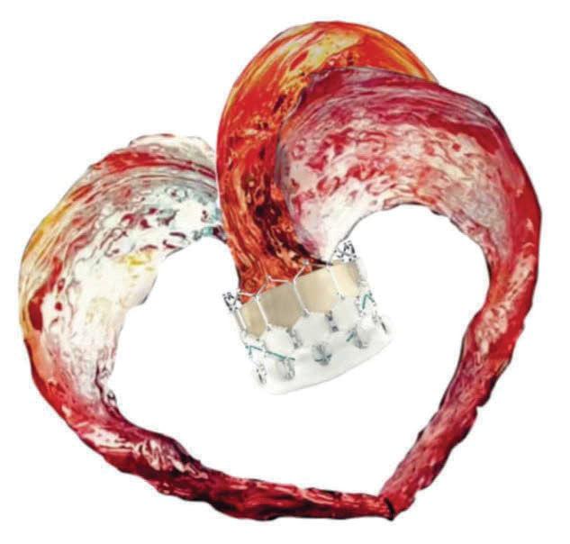 Healing the Heart Without Surgery: A Leap in Structural Interventions