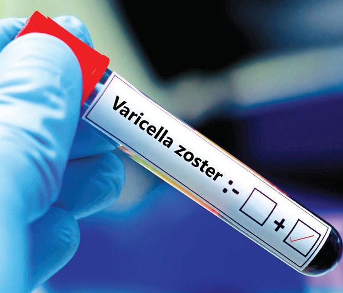 SHINGLES SHOT GOOD FOR HEART & BRAIN