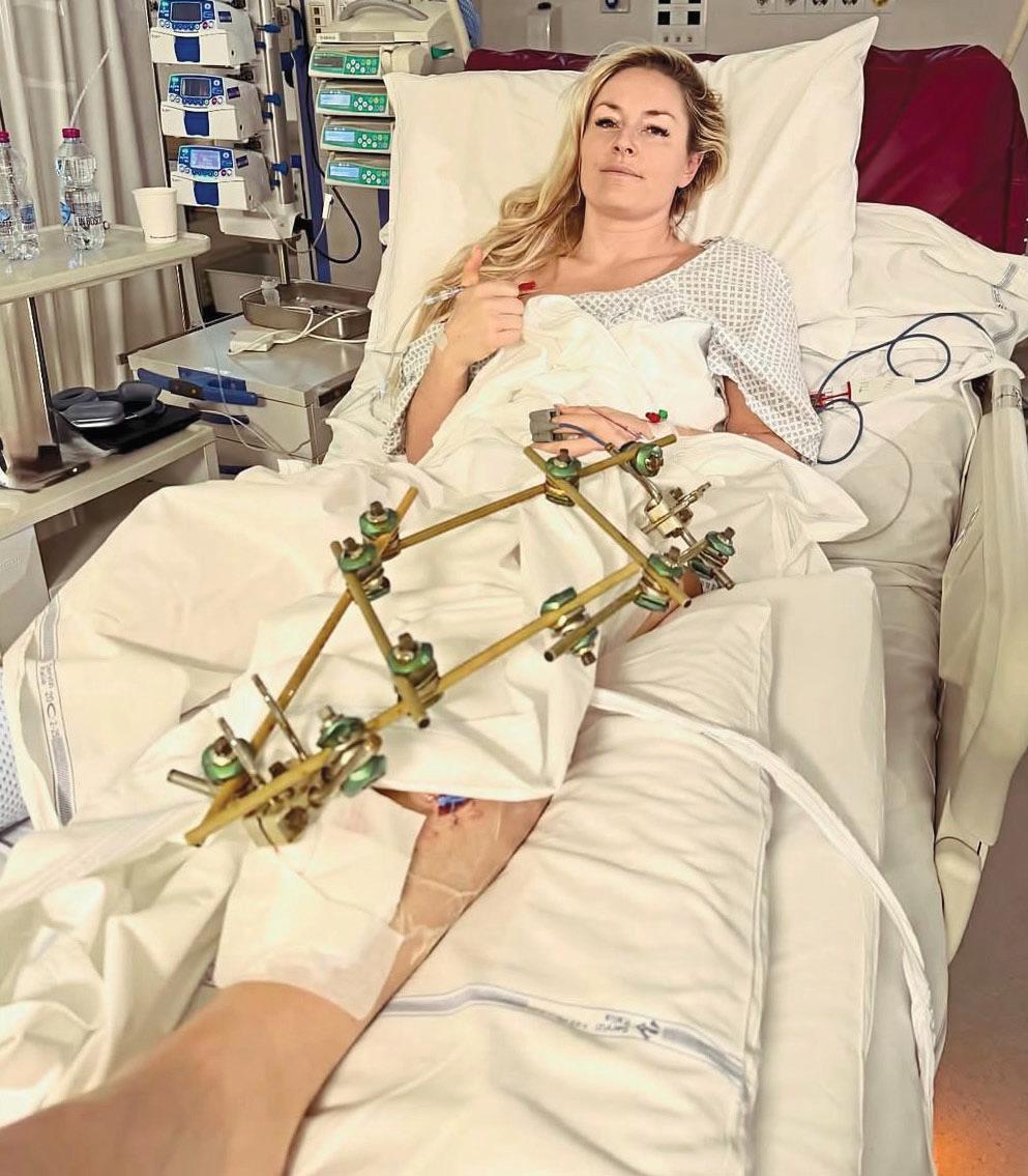 LINDSEY'S AMPUTATION HORROR!