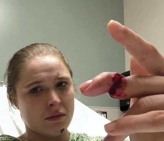 Ronda Is As Tough As Her Nails!
