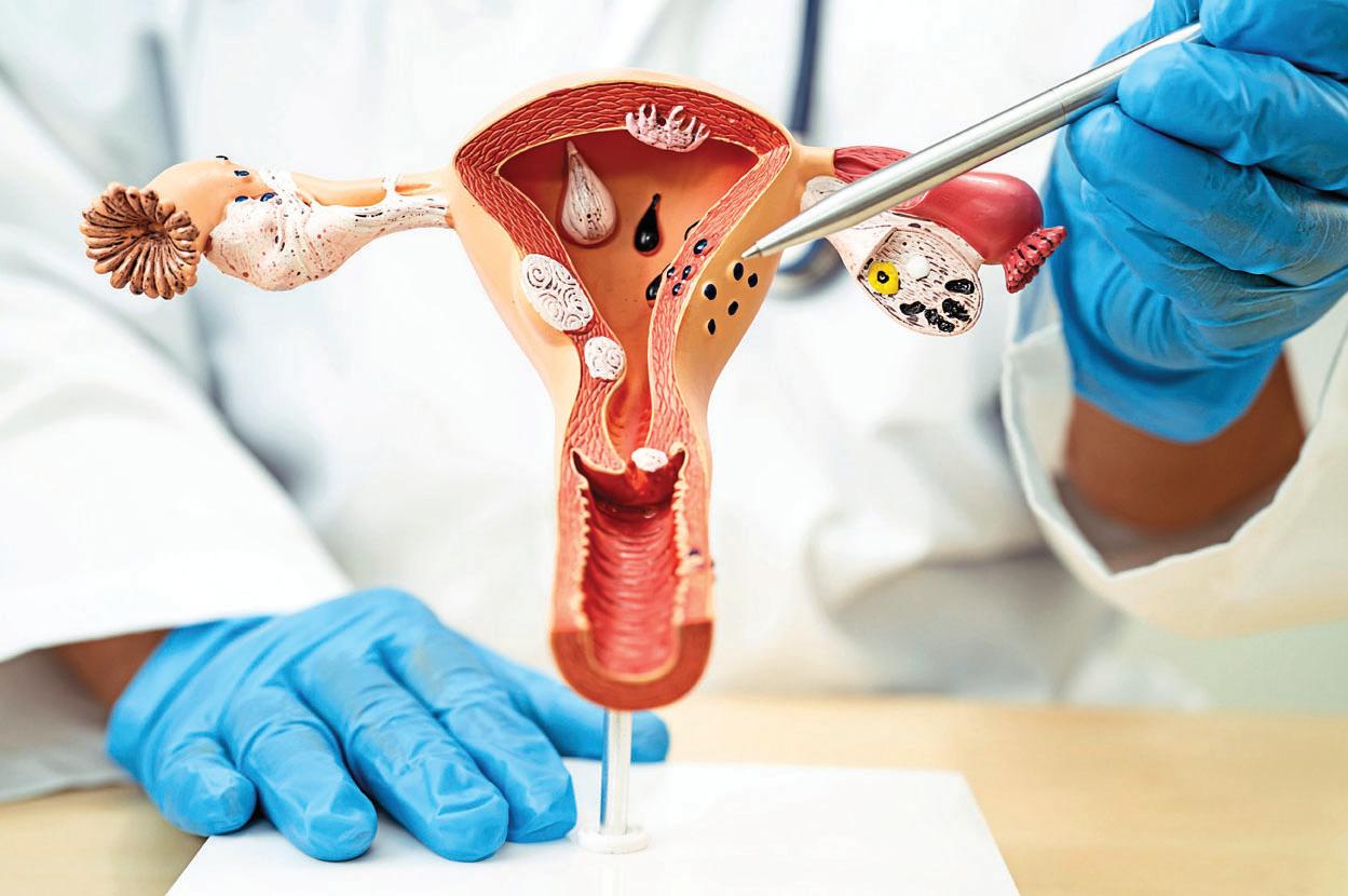 DIY SCREENER FOR CERVICAL CANCER