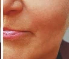 BETTER THAN BOTOX:Takes 10 Years Off Your Face in Just 10 Minutes
