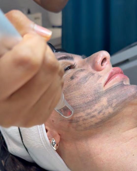 BEST PERSONALISED FACIAL TREATMENT BARE SKIN FACIAL + LASER BAR PERSONALISED FACIAL TREATMENT