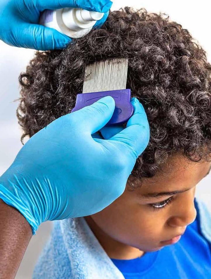 HANDLING HEAD LICE