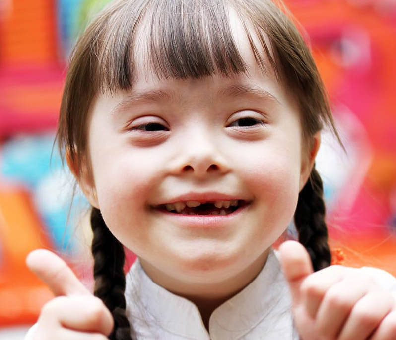 FACTS ABOUT DOWN'S SYNDROME