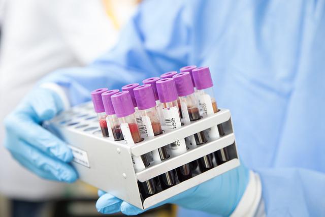 A Simple Blood Test Could Transform Alzheimer's Diagnosis