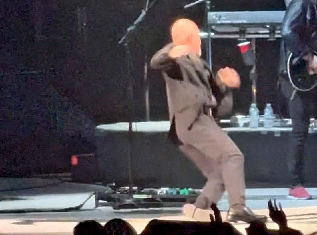 BILLY FALLS HARD FEARS AFTER STAGE SLIP