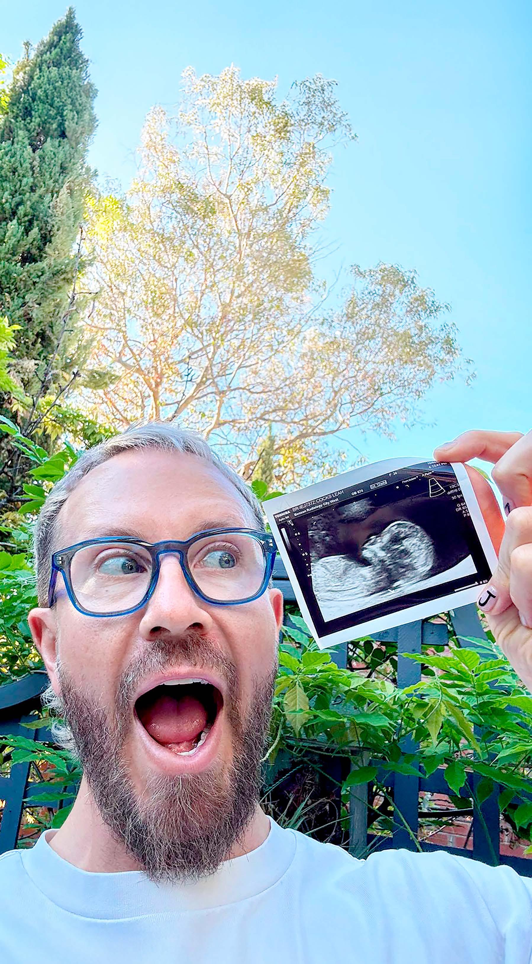 'SURPRISE, I'M HAVING A BABY!'