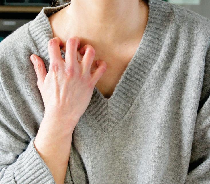 The rash you need to watch for