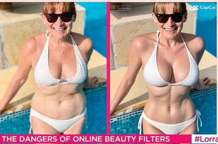 LORRAINE: 'I'VE GOT A BELLY, WHO HASN'T?'