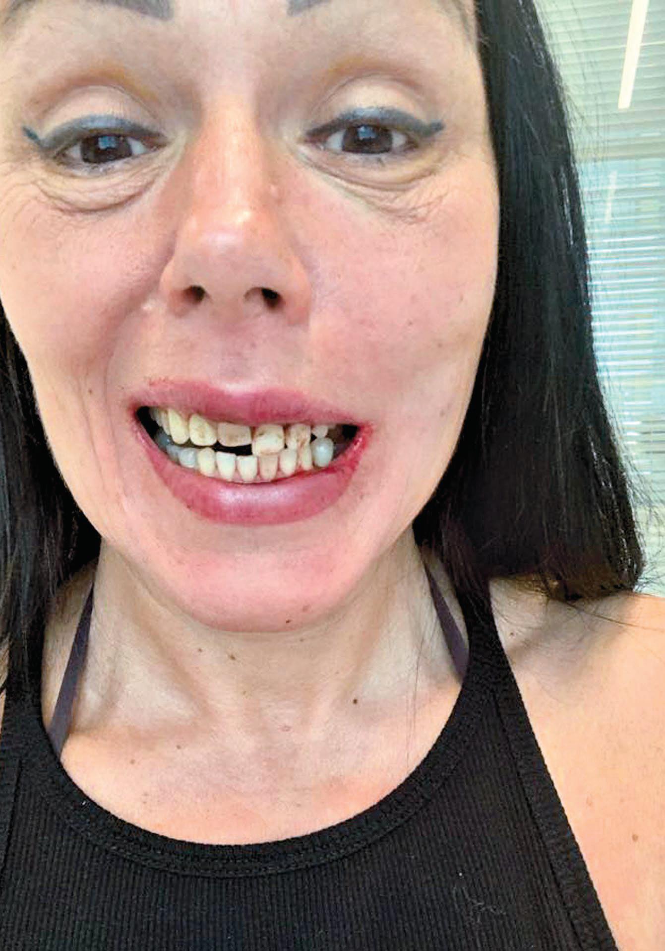 MY EX STOLE MY SMILE
