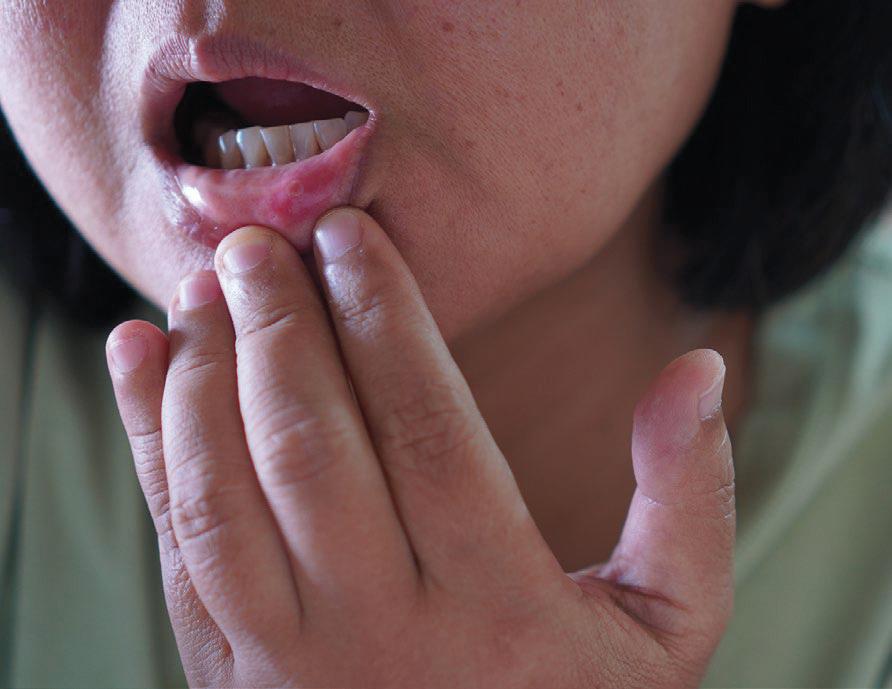 Vital signs to BEAT CANCER