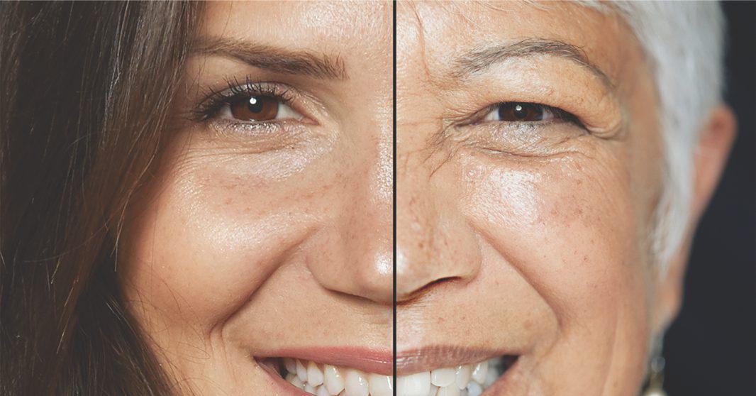 Aging Gracefully - One Wrinkle at a Time