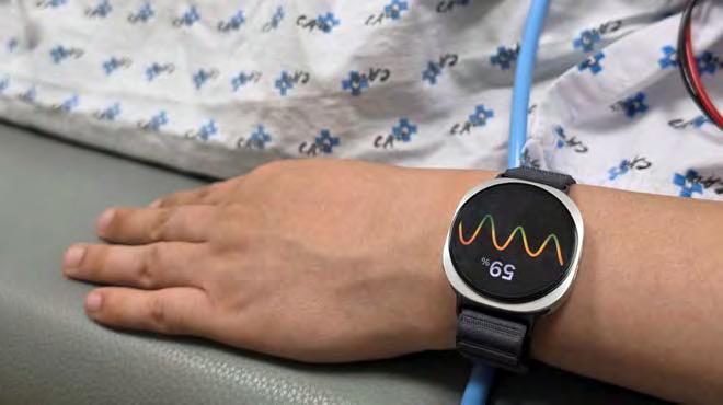 A Watch That Could Warn You Before You Faint