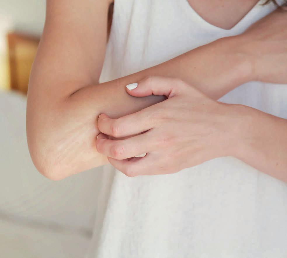 Dermatitis: qué es, por qué aparece y cómo calmarla