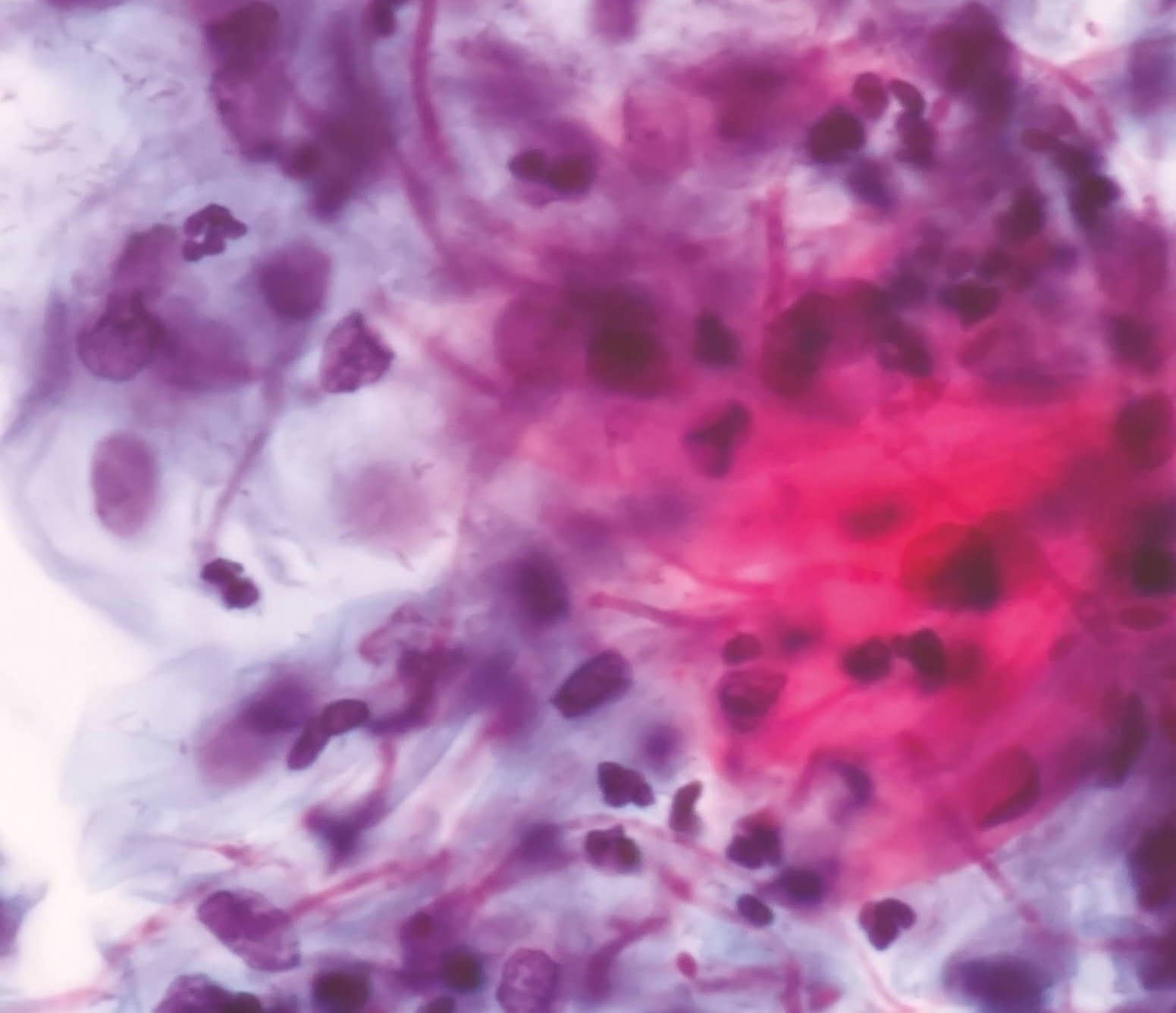 It's The Yeast You Can Do Candida And Your Immune System