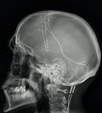 Moral Philosophy Can Help Explain Social Polarisation