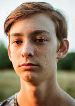 Teenage acne