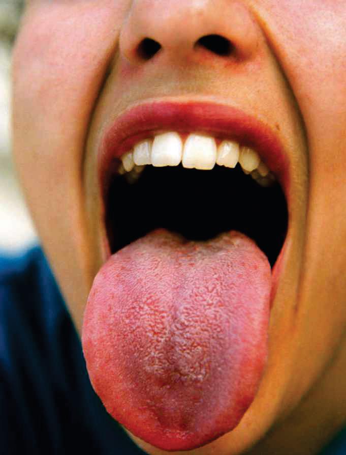 CAN I SWALLOW MY TONGUE?