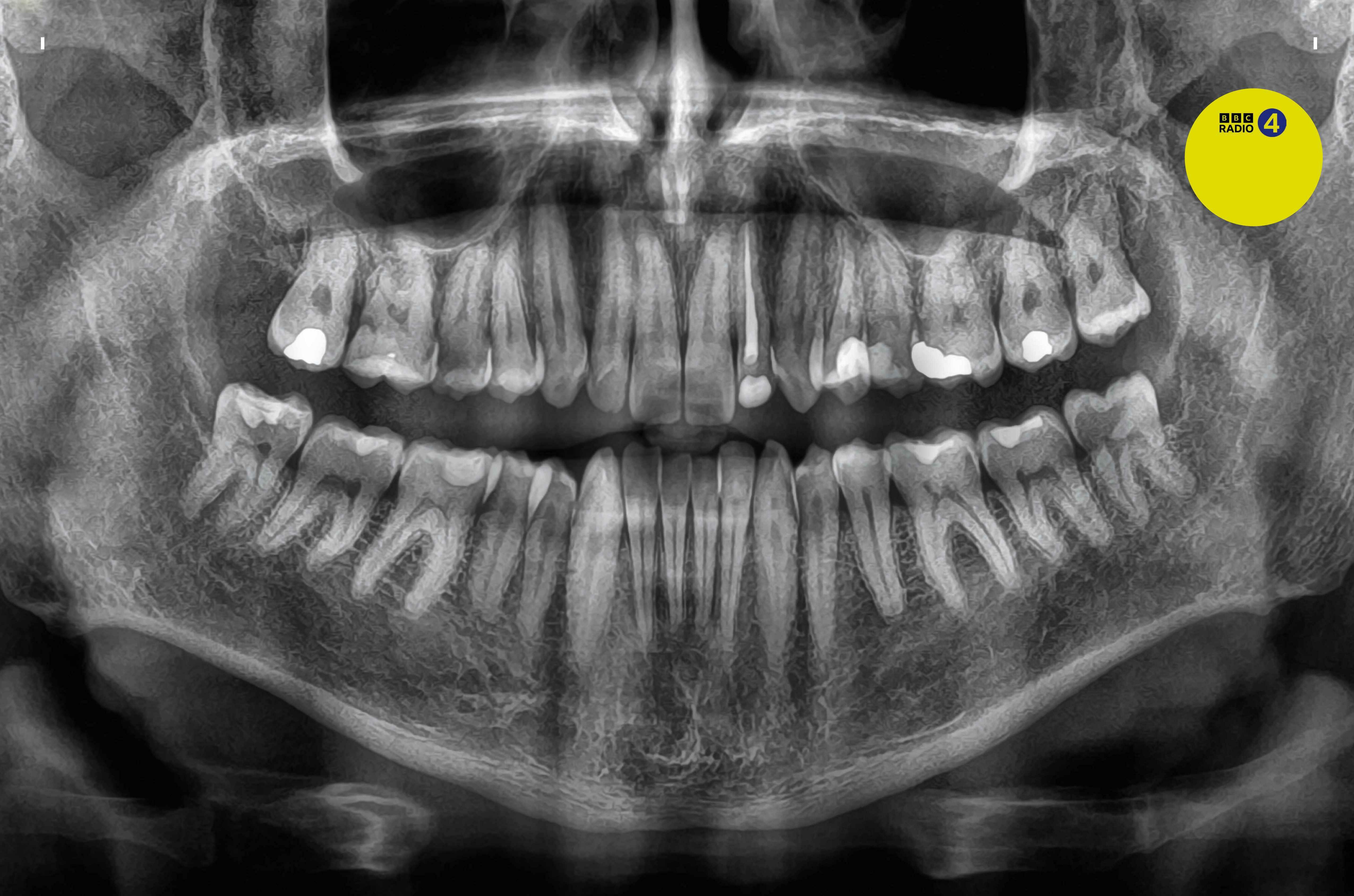 WATCH YOUR MOUTH | BBC Science Focus - science - Read this story on Magzter.com WATCH YOUR MOUTH | BBC Science Focus - science - Read this story on Magzter.com