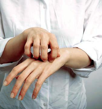 দাদ, হাজা, চুলকানি ও হাউজওয়াইফ এগজিমা