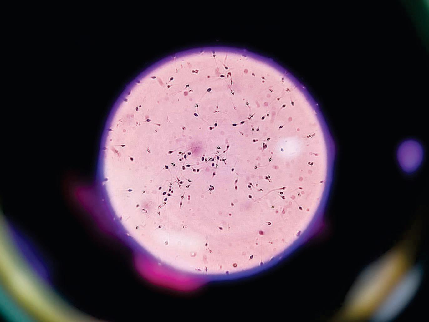 AI helped a couple get pregnant after 19 years