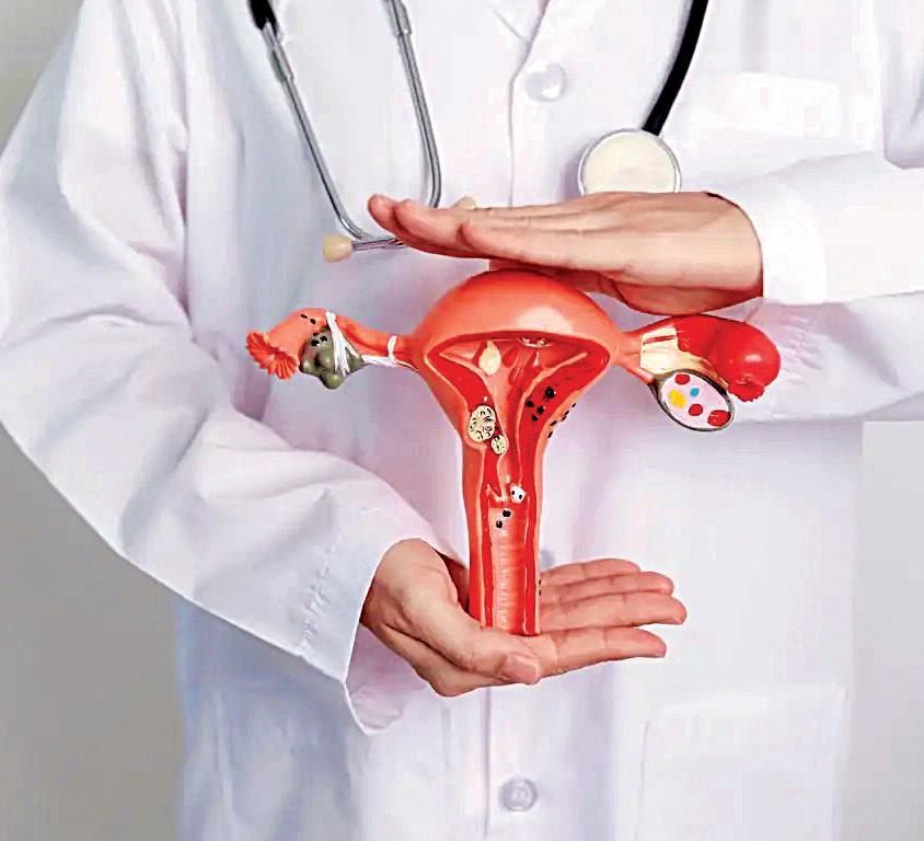 Vietnam launches project to accelerate cervical cancer testing