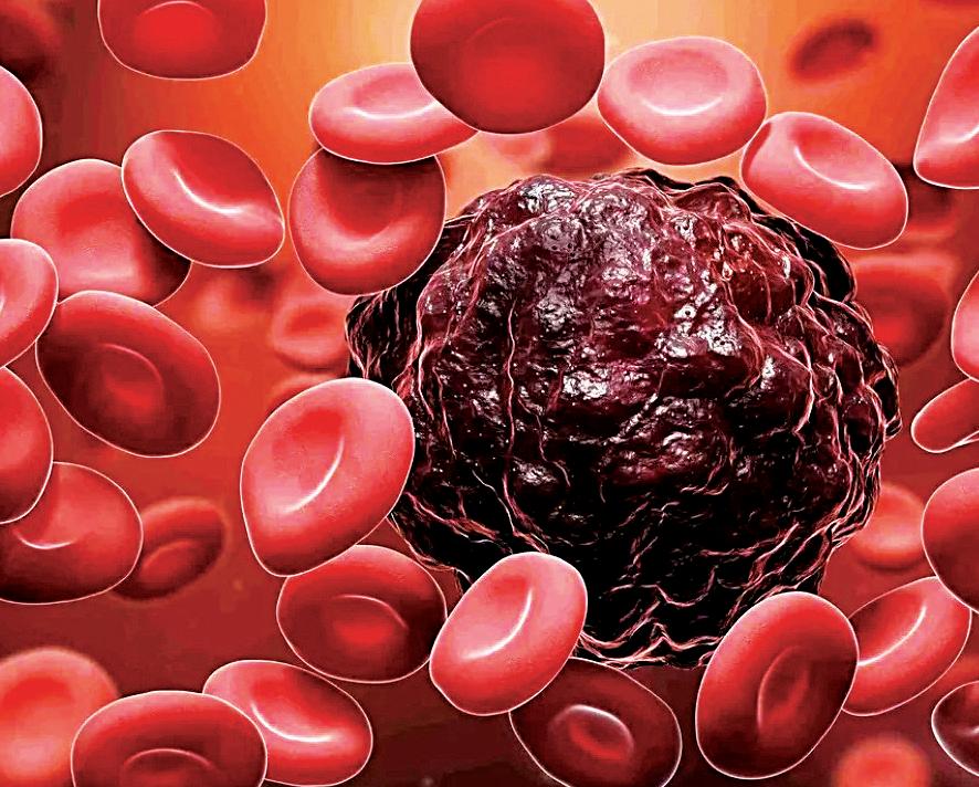 New tool by Singapore reveals hidden metabolic weakness in blood cancers