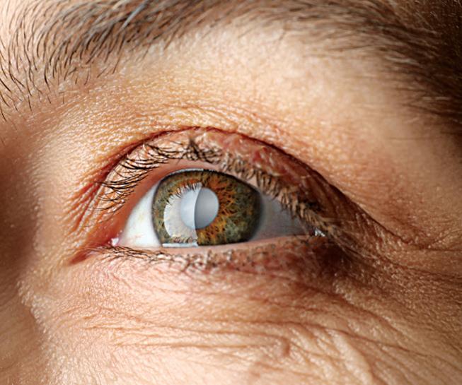 Retinal Gene Therapy secures regulatory approval in Japan