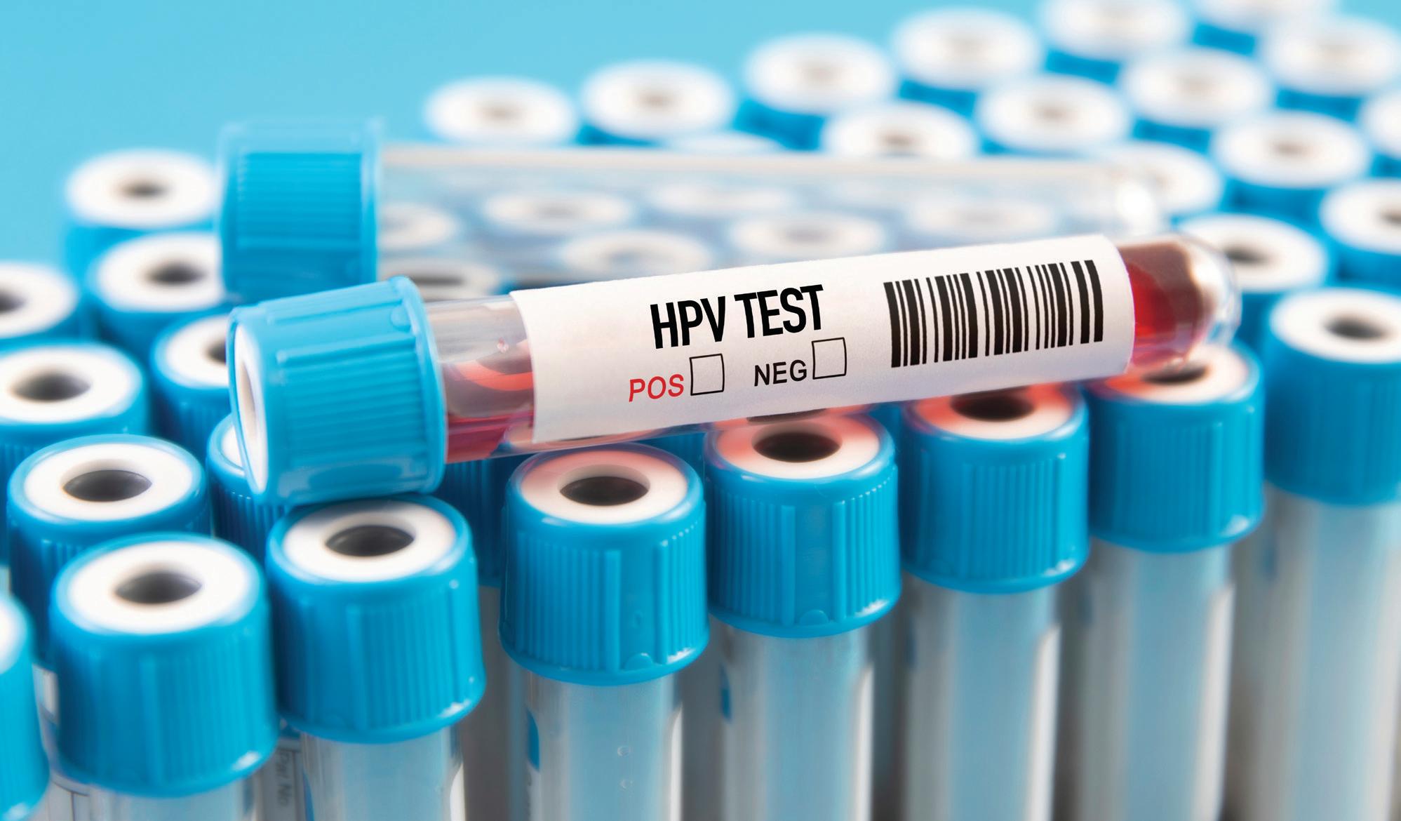 FROM AWARENESS TO ACTION: COMBATING HPV-LINKED ORAL CANCERS