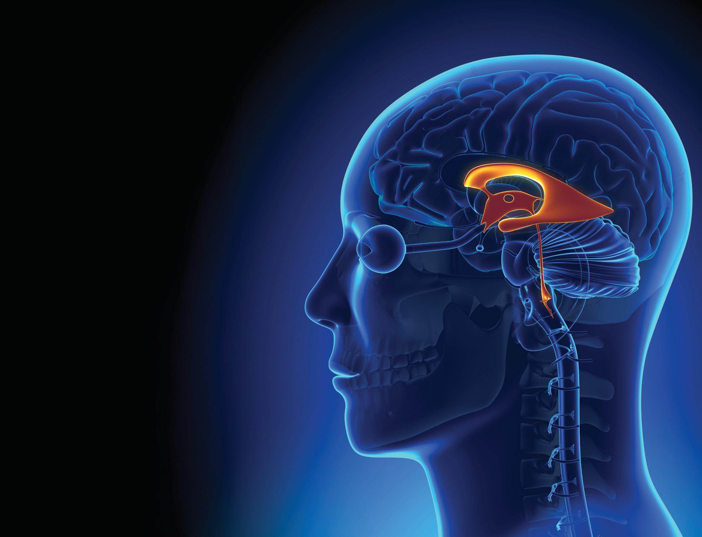 BRAIN UNDER PRESSURE WHY CEREBROSPINAL FLUID DESERVES STRATEGIC FOCUS IN HEALTHCARE
