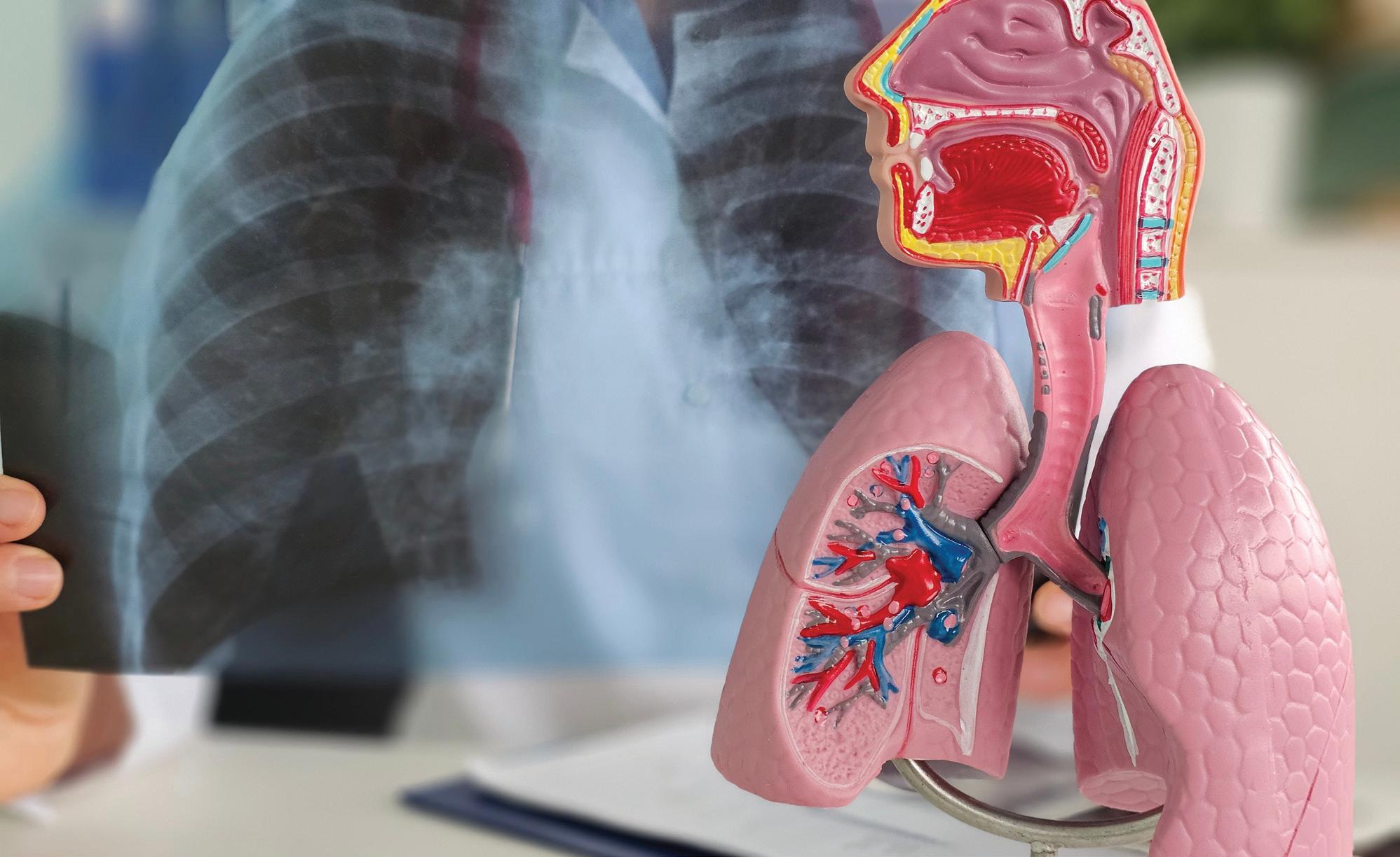 FIGHTING COPD IN INDIA INNOVATIONS AND CHALLENGES