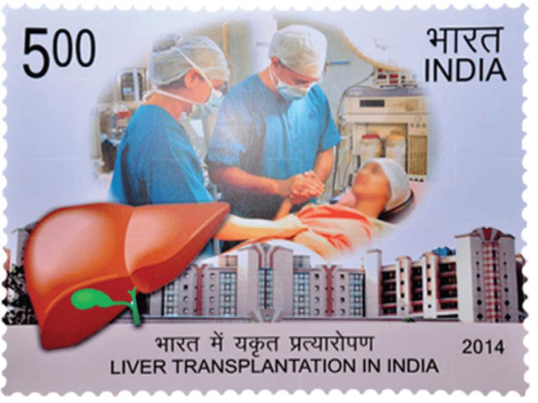 APOLLO HOSPITALS GROUP ACHIEVES LANDMARK SUCCESS WITH 5,000 LIVER TRANSPLANTS