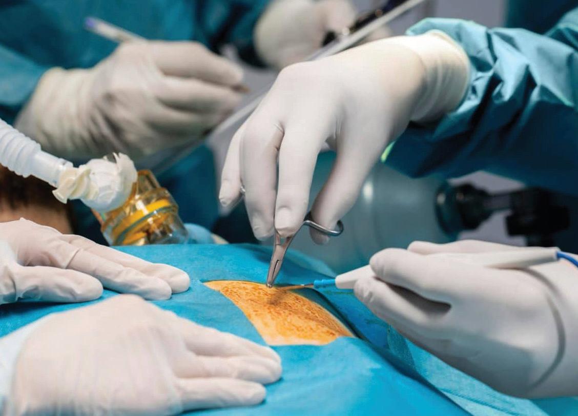 MINIMALLY INVASIVE BYPASS SAVES POSTTRANSPLANT CARDIAC PATIENT