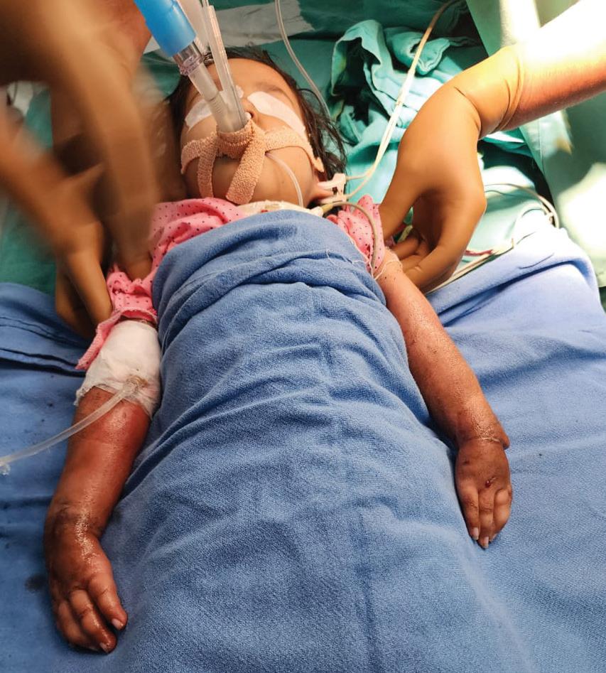 FORTIS ESCORTS CORRECTS RARE DEFORMITY; SAVES ANOTHER MAN'S LIMB