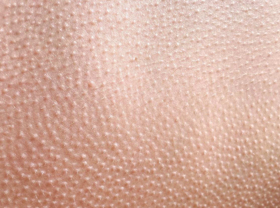 DO GEESE GET GOOSEBUMPS?
