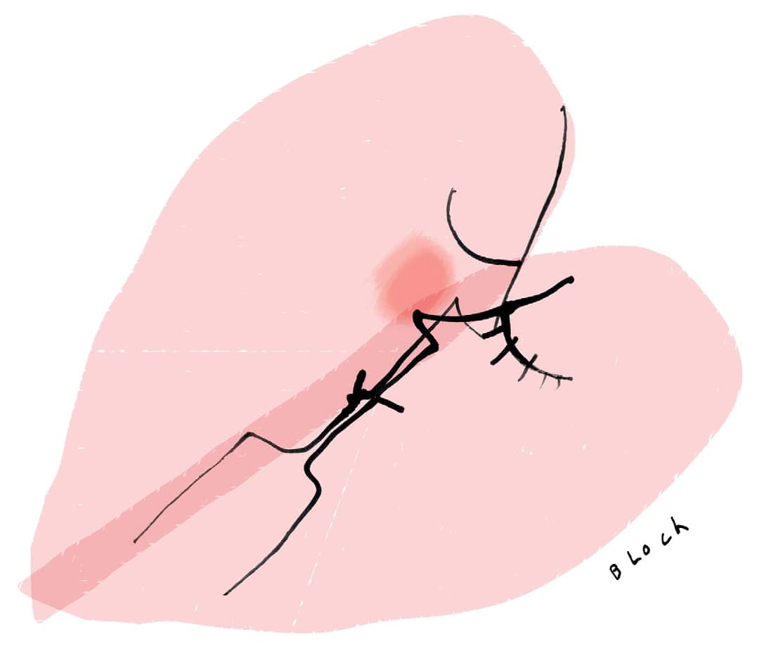 Datos curiosos de los besos