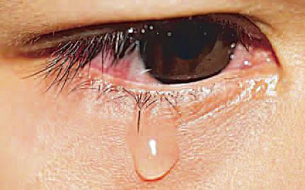 कम्प्यूटर, मोबाइल छीन रहे आपकी आंखों की नमी